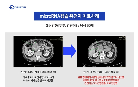 자료제공: 티시바이오, microRNA유전자치료에 의한 췌장암 치료사례